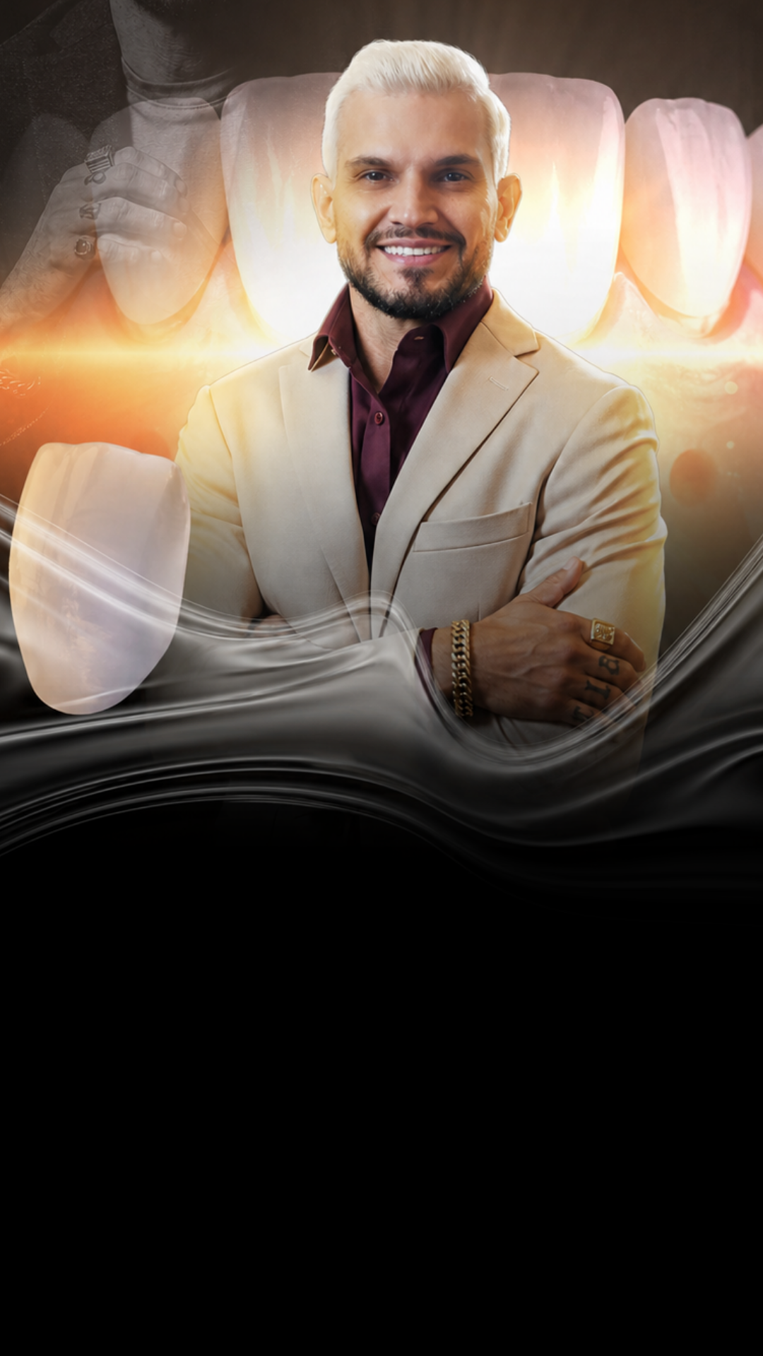Técnica Híbrida Direta e Indireta em Resina